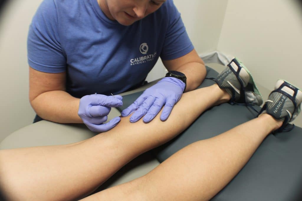 dry needling session on right leg
