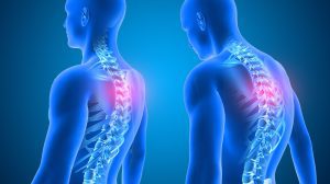 The Impact of Posture on Musculoskeletal Health