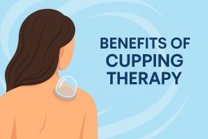 Benefits of Cupping Therapy: How It Works and Helps