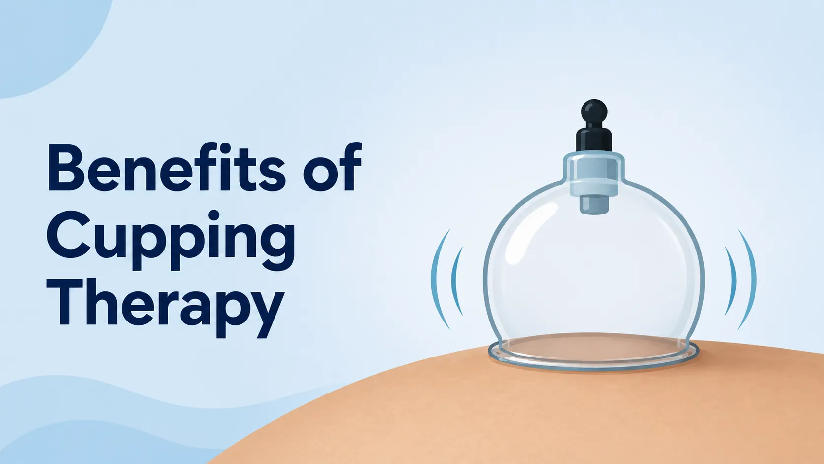 Benefits of Cupping Therapy: What Dry Cupping Does for Muscles and Mobility
