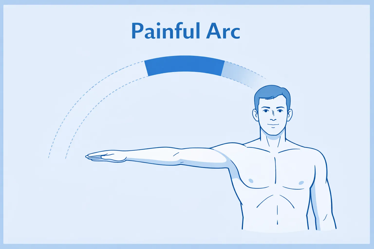 painful arc featured image